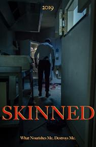 Skinned poster